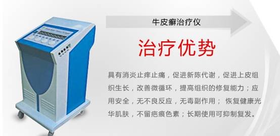 牛皮癣治疗仪